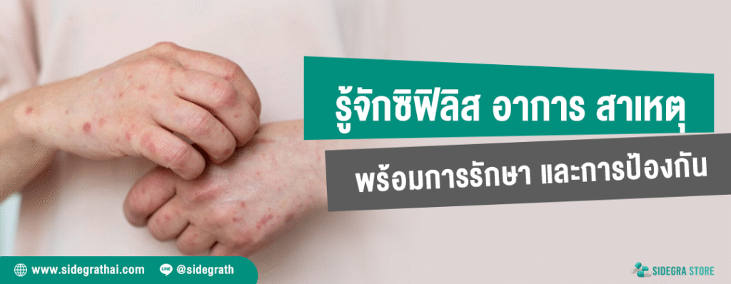 ซิฟิลิส ภัยเงียบจากเพศสัมพันธ์ที่ป้องกันและรักษาได้