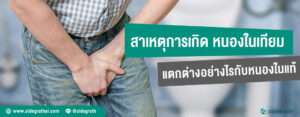 หนองในเทียม สาเหตุและวิธีสังเกตต่างกันอย่างไรกับหนองในแท้