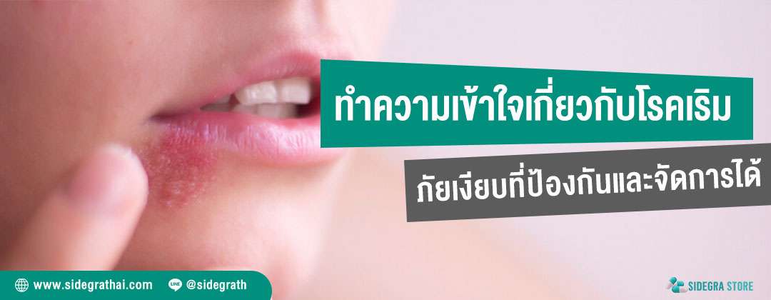 โรคเริม ทำความเข้าใจ ภัยเงียบที่ป้องกันและจัดการได้